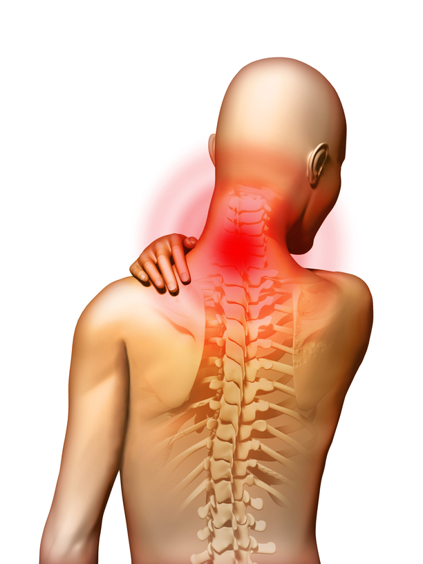 Neck pain